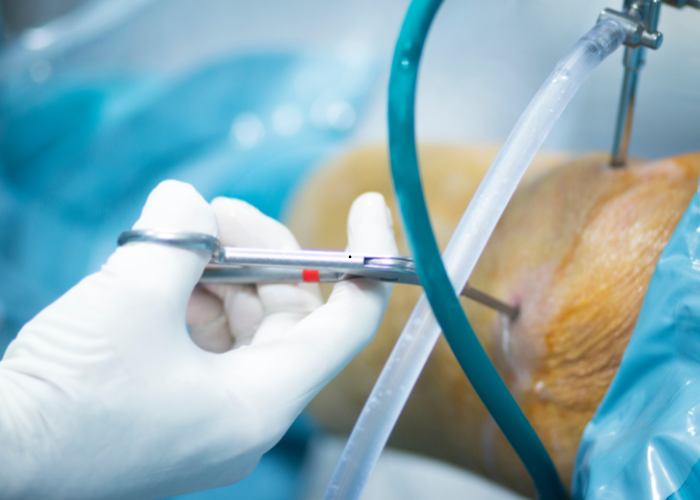 Bienvenue sur la Revue Nigerienne de Chirugie Orthopédique  et Traumatologique